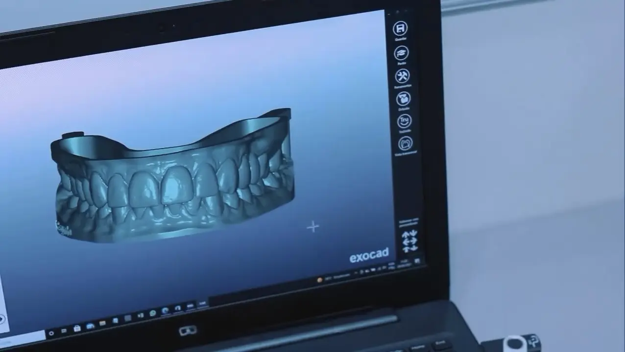 Escaneamento e modelo odontológico digital