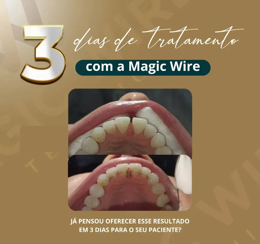 Arte do Magic Wire com imagens clínicas comparativas