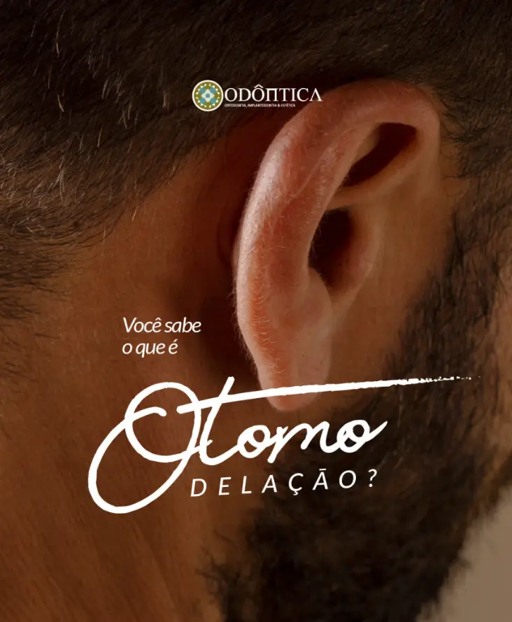 Publicação da Odôntica sobre otomodelação